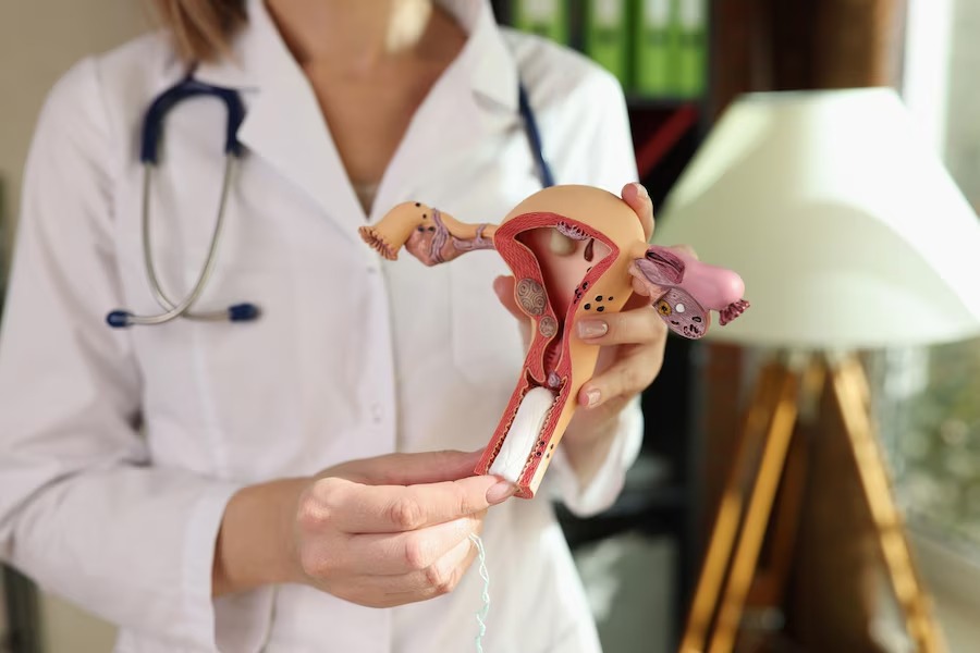 Sutureless Hysterectomy in Indore