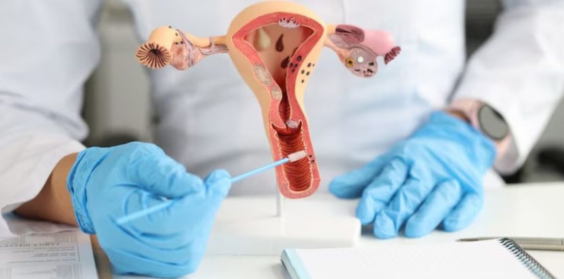 gynecological care in Indore, gynecologist in Indore